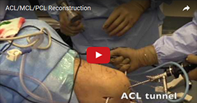 ACL/MCL/PCL Reconstruction 