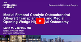 Medial Femoral Condyle Osteochondral Allograft Transplantation and Medial Opening Wedge High Tibial