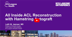All Inside ACL Reconstruction with Hamstring Autograft