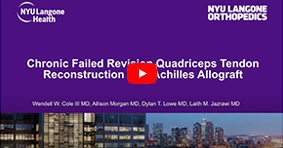Chronic Failed Revision Quadriceps Tendon Reconstruction with Achilles Allograft