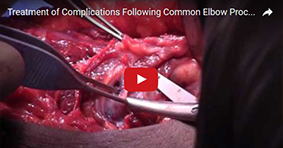 Treatment of Complications Following Common Elbow Procedures