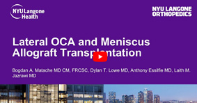 Lateral OCA and Meniscus Allograft Transplantation
