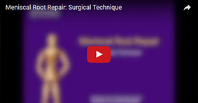 Meniscal Root Repair: Surgical Technique