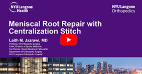 Meniscal Root Repair with Centralization Stitch