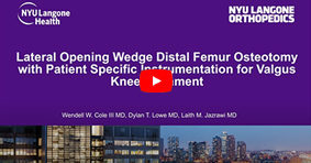 Lateral Opening Wedge Distal Femur Osteotomy (DFO) with Patient Specific Instrumentation (PSI)
