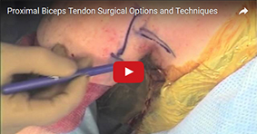Proximal Biceps Tendon Surgical Options
