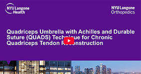 Quadriceps Umbrella with Achilles and Durable Suture (QUADS) for Chronic Quad Tendon Reconstruction