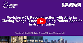 Revision ACL Recon & Anterior Closing Wedge Osteotomy using Patient Specific Instrumentation