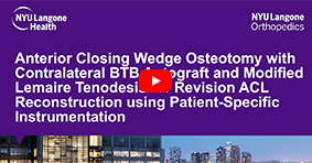 Single-Stage Revision ACL with Anterior Closing Wedge Osteotomy & LET using PSI