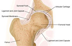 THE HEALTHY HIP