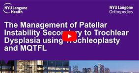 Trochleoplasty with Combined Soft Tissue Reconstruction for Patellar Instability