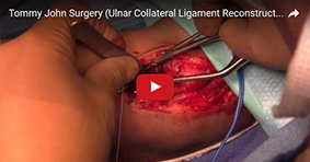 Tommy John Surgery (Ulnar Collateral Ligament Reconstruction)